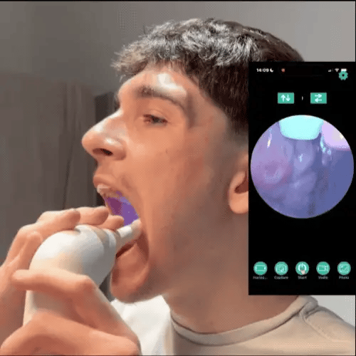 OraPure™ I Nero Pro Smart Tonsil Cleaner