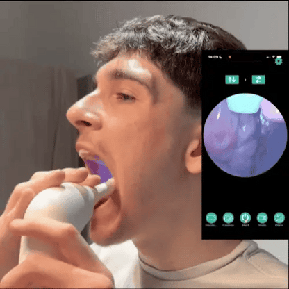 OraPure™ I Nero Pro Smart Tonsil Cleaner